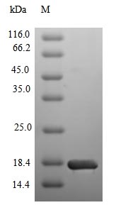 Recombinant Human Sodium/glucose cotransporter 2(SLC5A2),partial