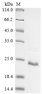 Recombinant Human Solute carrier organic anion transporter family member 2B1(SLCO2B1),partial