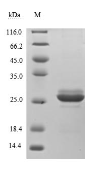 Recombinant Human Somatotropin(GH1) (Active)