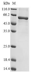 Recombinant Human Spectrin alpha chain, erythrocytic 1(SPTA1)，partial