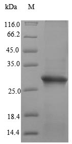 Recombinant Human Sperm-egg fusion protein Juno(IZUMO1R)