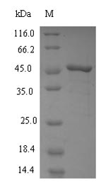 Recombinant Human Squalene synthase(FDFT1),partial 