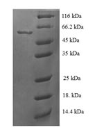 Recombinant Human Steroid 21-hydroxylase(CYP21A2)