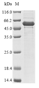 Recombinant Human Steroidogenic factor 1(NR5A1),partial