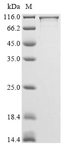 Recombinant Human Striatin-3(STRN3)