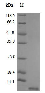 Recombinant Human Stromal cell-derived factor 1 protein(CXCL12) (Active)