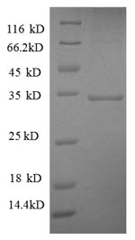 Recombinant Human Succinate dehydrogenase [ubiquinone] flavoprotein subunit, mitochondrial(SDHA),partial