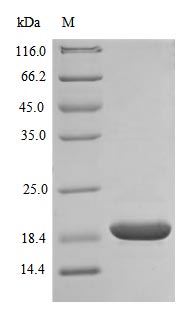 Recombinant Human Superoxide dismutase [Cu-Zn] protein(SOD1) (Active)