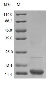 Recombinant Human Superoxide dismutase [Cu-Zn] protein(SOD1) (Active)