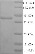 Recombinant Human Syndecan-1(SDC1),partial