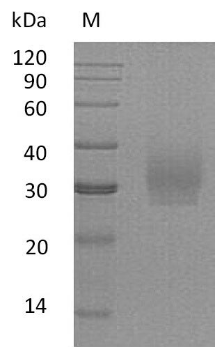 Recombinant Human Syndecan-2(SDC2),partial (Active)