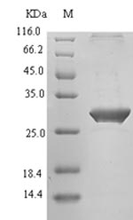 Recombinant Human T-cell immunoreceptor with Ig and ITIM domains(TIGIT),partial