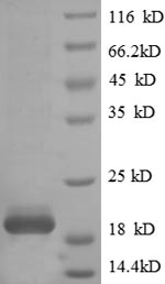 Recombinant Human T cell receptor alpha constant(TRAC)