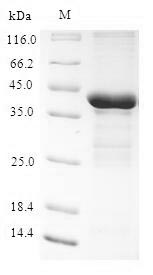 Recombinant Human Tescalcin(TESC)