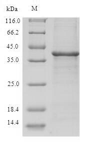 Recombinant Human Thioredoxin domain-containing protein 17(TXNDC17)
