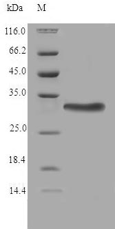 Recombinant Human Thioredoxin-related transmembrane protein 2(TMX2),partial
