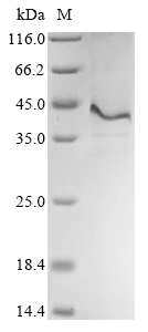 Recombinant Human Thrombomodulin(THBD),partial
