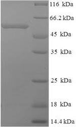 Recombinant Human Thrombopoietin receptor(MPL),partial