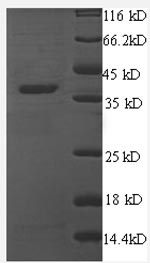 Recombinant Human Thrombospondin-1(THBS1) ,partial