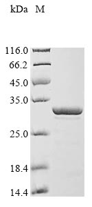 Recombinant Human Thymosin beta-10(TMSB10)