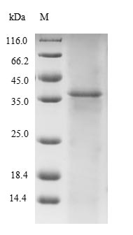 Recombinant Human Titin(TTN),partial