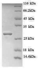 Recombinant Human Titin(TTN),partial