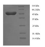 Recombinant Human Transcriptional enhancer factor TEF-5(TEAD3),partial