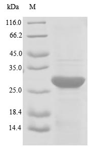 Recombinant Human Transformer-2 protein homolog beta(TRA2B),partial