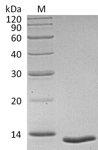 Recombinant Human Transforming growth factor beta-1 proprotein(TGFB1),partial (Active)