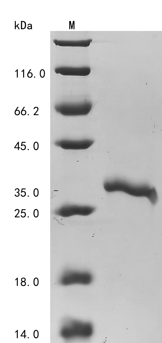 Recombinant Human Transgelin-2(TAGLN2)