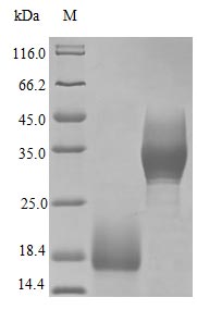 Recombinant Human Trefoil factor 3 protein(TFF3) (Active)