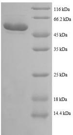 Recombinant Human Trifunctional enzyme subunit beta, mitochondrial(HADHB),partial