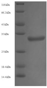 Recombinant Human Trimethylguanosine synthase(TGS1) ,partial