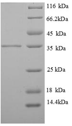Recombinant Human Tropomyosin beta chain(TPM2),partial