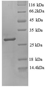 Recombinant Human Trypsin-3(PRSS3),partial