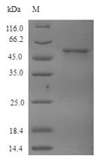 Recombinant Human Tubulin beta-4A chain(TUBB4A)