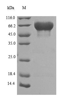 Recombinant Human Tumor-associated calcium signal transducer 2(TACSTD2),partial (Active)