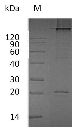 Recombinant Human Tumor necrosis factor ligand superfamily member 11(TNFSF11),partial (Active)