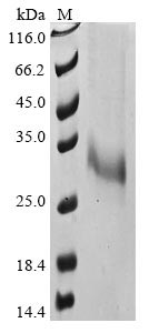 Recombinant Human Tumor necrosis factor ligand superfamily member 11(TNFSF11),partial