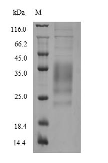 Recombinant Human Tumor necrosis factor ligand superfamily member 8(TNFSF8),partial (Active)
