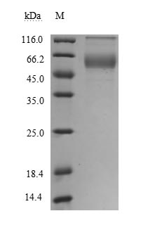 Recombinant Human Tumor necrosis factor ligand superfamily member 8(TNFSF8),partial (Active)