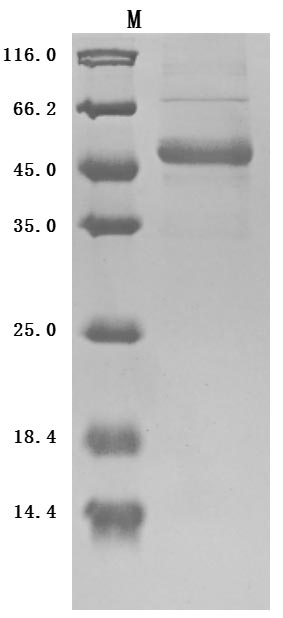 Recombinant Human Tumor necrosis factor ligand superfamily member 9(TNFSF9),partial (Active)