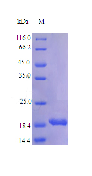 Recombinant Human Tumor necrosis factor ligand superfamily member 9 protein(TNFSF9) (Active)