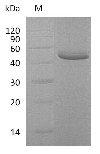 Recombinant Human Tumor necrosis factor receptor superfamily member 10B(TNFRSF10B),partial (Active)