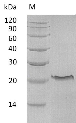 Recombinant Human Tumor necrosis factor receptor superfamily member 10C(TNFRSF10C),partial (Active)