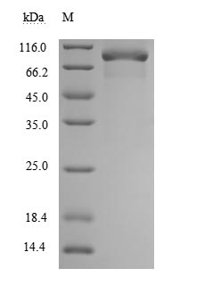 Recombinant Human Tumor necrosis factor receptor superfamily member 11B(TNFRSF11B) (Active)