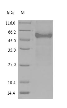 Recombinant Human Tumor necrosis factor receptor superfamily member 14(TNFRSF14) ,partial (Active)