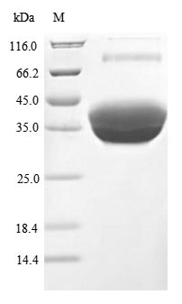 Recombinant Human Tumor necrosis factor receptor superfamily member 17(TNFRSF17),partial (Active)