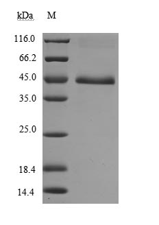 Recombinant Human Tumor necrosis factor receptor superfamily member 18(TNFRSF18),partial (Active)