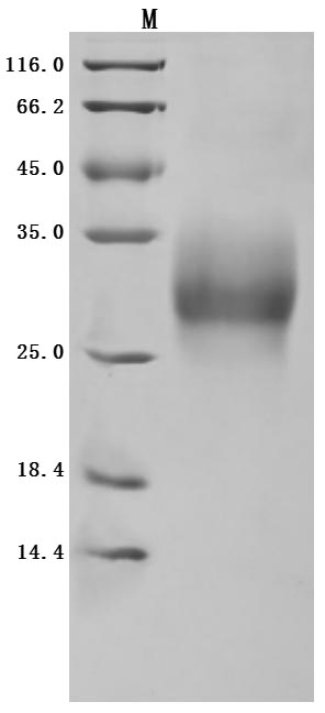 Recombinant Human Tumor necrosis factor receptor superfamily member 9(TNFRSF9),partial (Active)